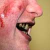 Zombie Make Up - Teeth